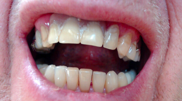THE LINK BETWEEN DENTAL HEALTH AND SUBSTANCE ABUSE-AR8