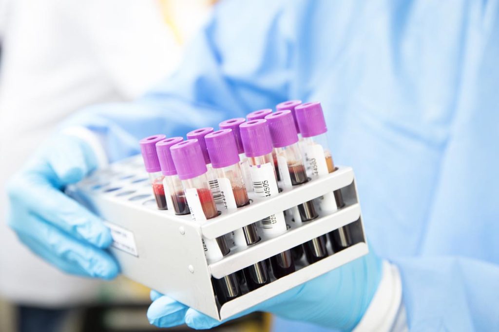How Long Does Marijuana Stay in Your System?-medical technician holding a tray of blood extracts from people for a drug test