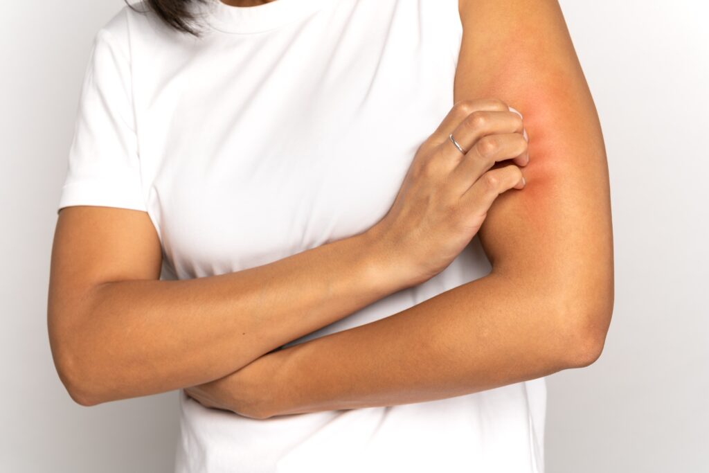 Drugs That Cause Skin Picking--Drugs-That-Cause-Skin-Picking.jpg