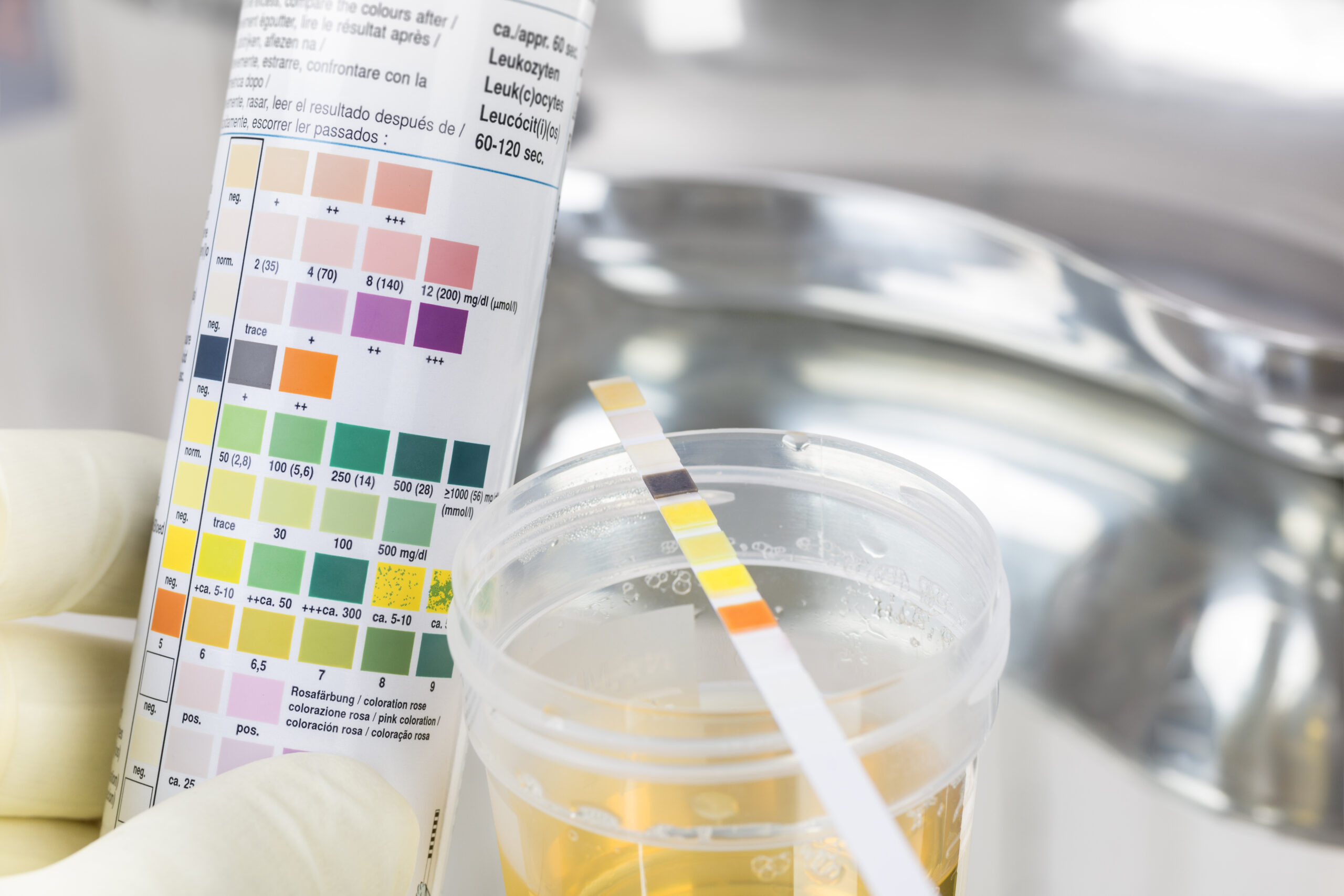 Best THC Detox Methods for Urine Tests: A Science-Based Guide-thc1.jpg