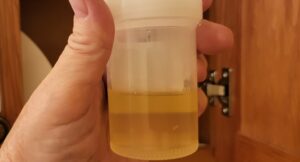 How long does thc stay in urine for drug test?-Urine-drug-test.jpg