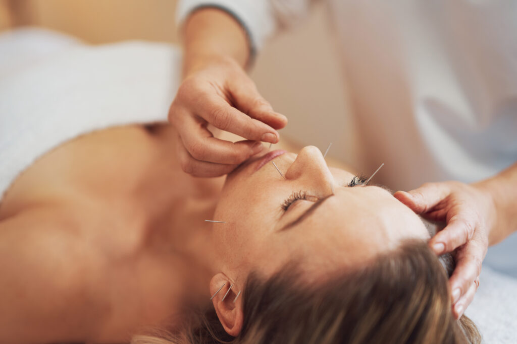 Can Acupuncture Help with Alcohol Addiction?-accuúnture for alcohol 1.jpg