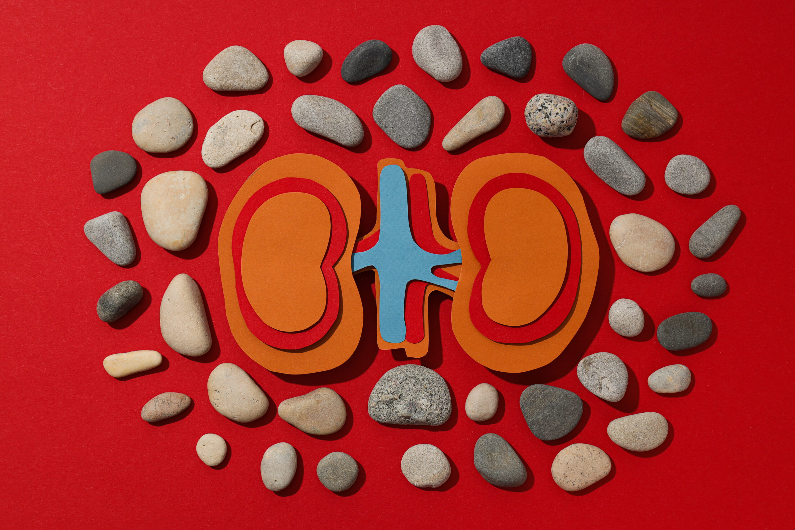 The Impact of Adderall on Kidney Health-adderal and kidneys 2.jpg