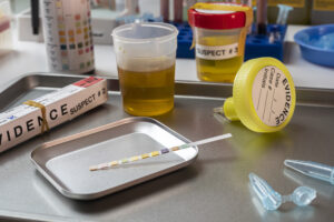 How long does it take for adderall to get out of your urine?-adderrall-urine-test.jpg