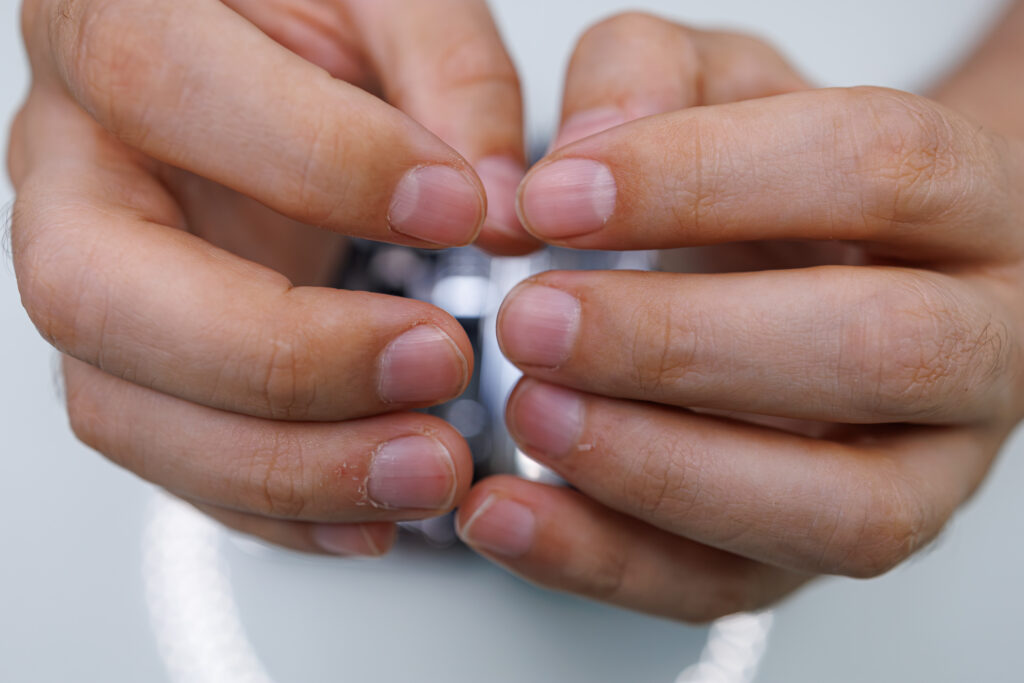 What You Need to Know About Fingernail Drug Testing-close-up-of-uncut-male-fingernails-a-man-gives-hi-2023-11-27-05-21-50-utc.jpg