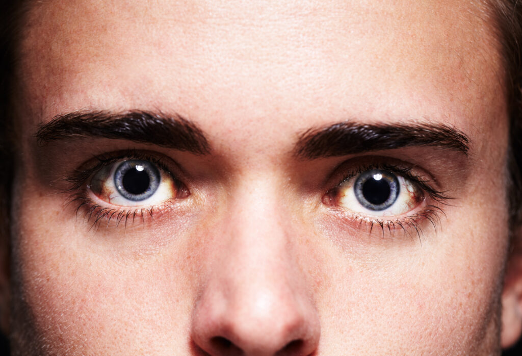 Understanding Cocaine Eyes-coke eyes 1.jpg