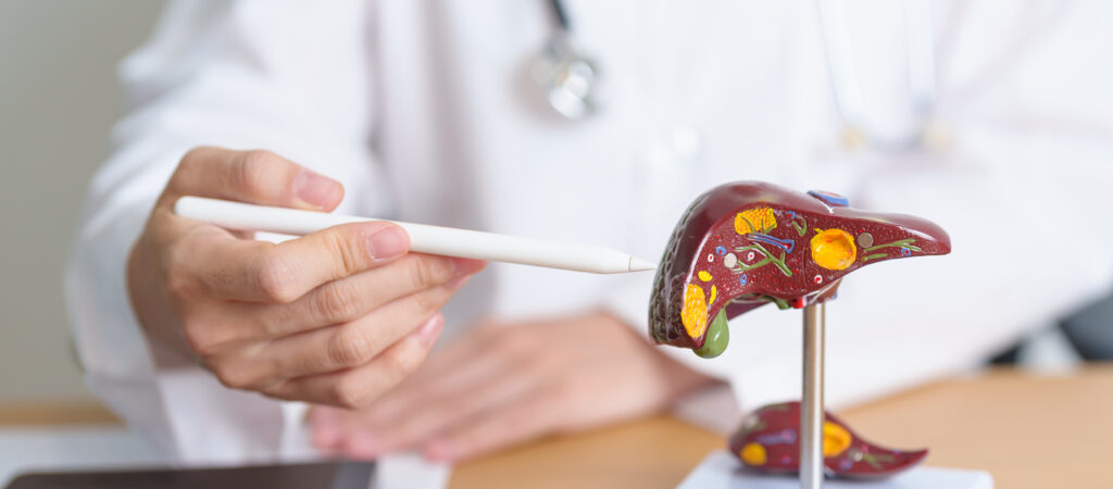 The Complex Relationship Between Alcohol and Gallstones-gallstones and alcohol1.jpg