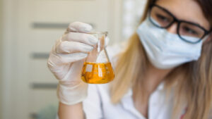 Can you test for lsd in urine?-lsd-urine.JPG