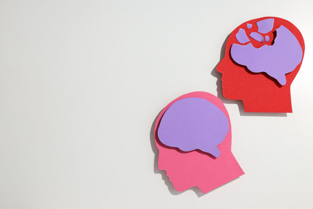 Understanding Methamphetamine's Impact on the Brain-meth brain damage 1.jpg