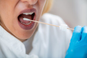 How to pass a mouth swab for meth-mouth-swab-meth.jpg