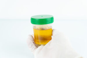 How long does thc stay in your urine?-urine-test.jpeg